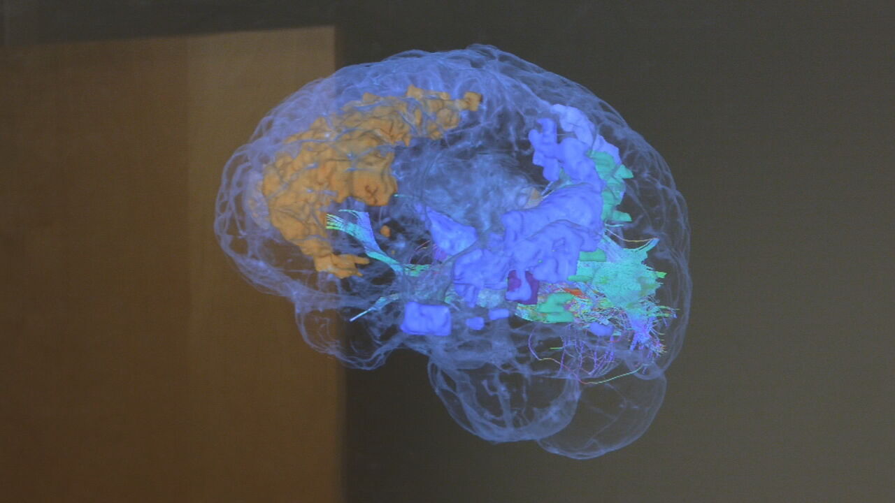 Norton VR Technology For Surgeries